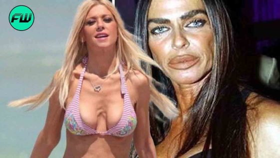 Celebrity Plastic Surgery Disasters No Fan Was Ready For