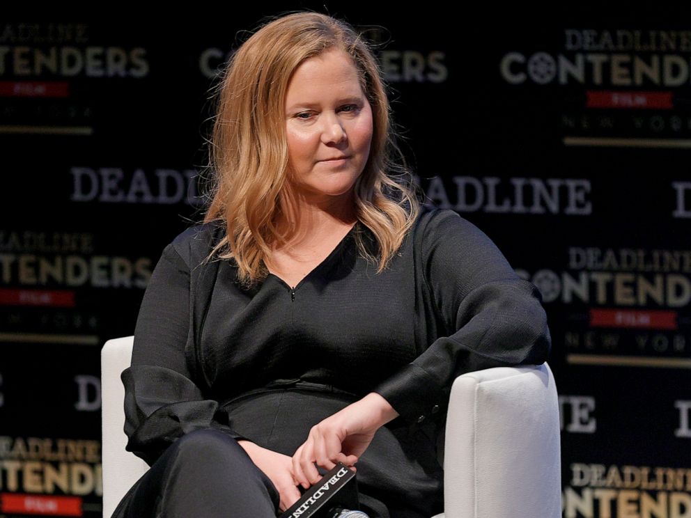 One of the actors rejected due to her looks: Amy Schumer