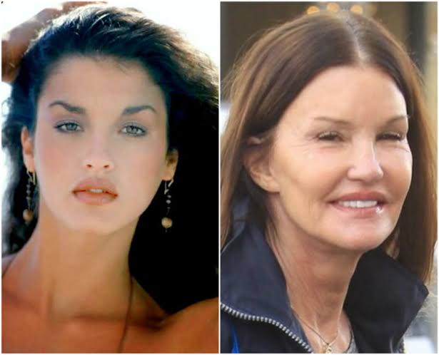 Celebs who ruined life due to plastic surgery
